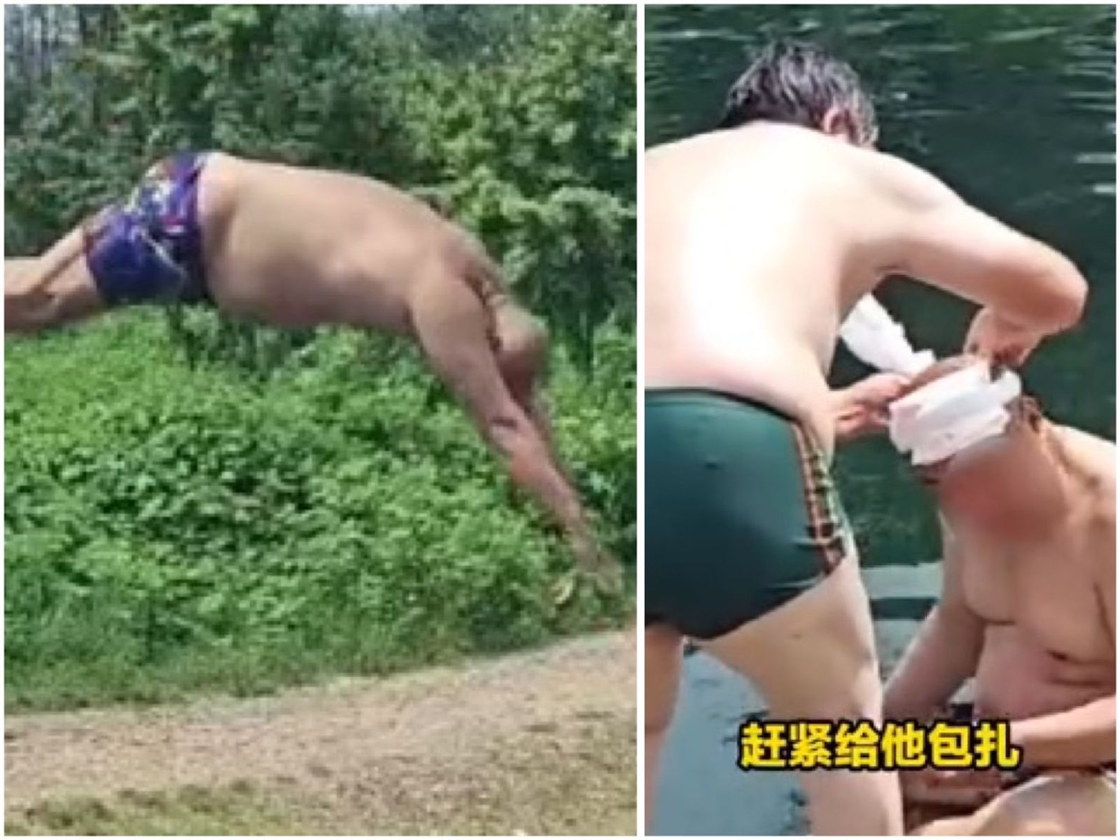中國男模仿全紅嬋水花消失術，結果頭破血流。（翻攝微博）